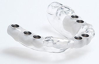 Dental Implant Services